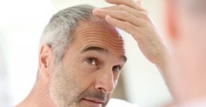 درمان ریزش مو بر اثر کم کاری کبد در طب سنتی