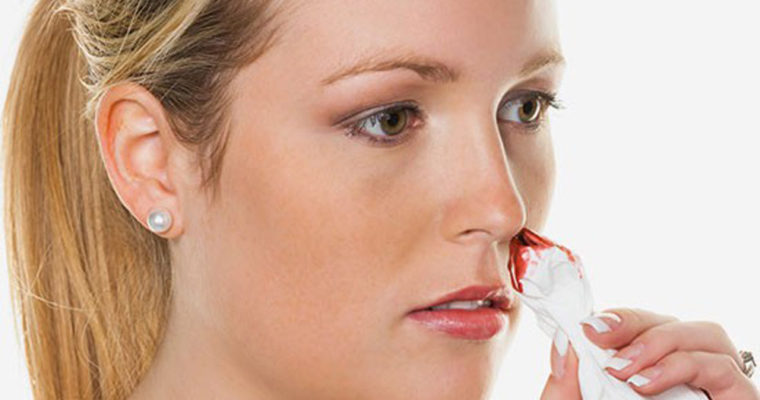 کنترل کردن خونریزی بینی با طب سنتی