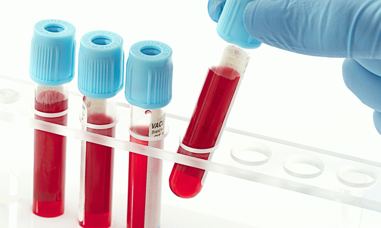 توصیه های طلایی برای تصفیه و پاکسازی خون در طب سنتی