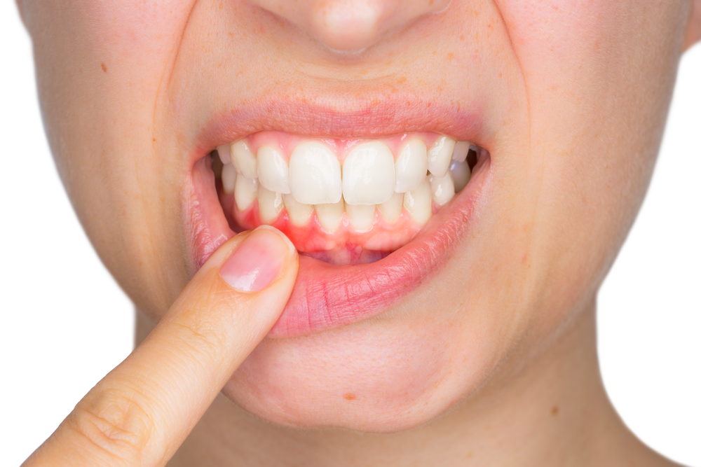 عفونت دندان و درمان آن با طب سنتی