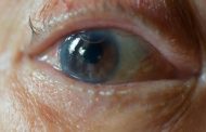 درمان آب مروارید و آب سیاه چشم