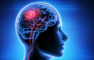 درمان تومور مغزی با طب سنتی